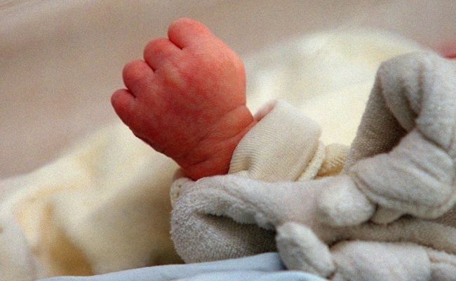 حالة طبية نادرة.. ولادة طفل برازيلي بذيل في نهايته كرة