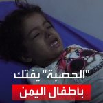 فيديو: ..الحصبة.. يفتك بأطفال اليمن وسط مناشدات للجهات الدولية بالتدخل