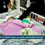 فيديو: نجاح فصل التوأم السيامي اليمني في عملية استغرقت 15 ساعة