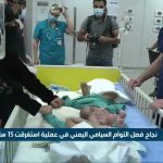 فيديو: وفاة أحد التوأم السيامي اليمني