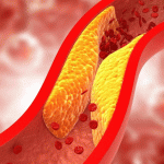 3 أعراض مرتبطة بالروائح تكشف مؤشرات الكوليسترول في الدم