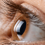 استشاري طب عيون: إهمال ضعف النظر قد يؤدي إلى العمى التام